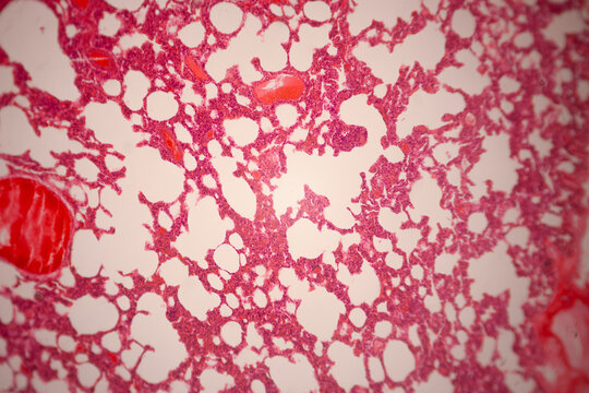 Microscopically stained section of lung tissue showing alveolar spaces, branching red blood vessels, and cellular structures.