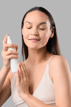 Young woman with acne problem holding medical spray on white background