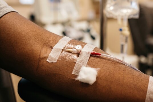 Arm of a person donating blood with intravenous cannula and tape in a clinical setting for medical education, healthcare campaigns and blood donation awareness