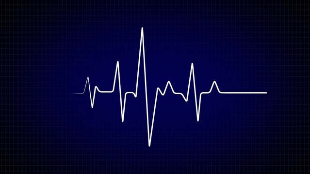 White electrocardiogram (ecg) heartbeat line on dark blue grid background, centered waveform with peaks and troughs, minimalist medical concept, high contrast