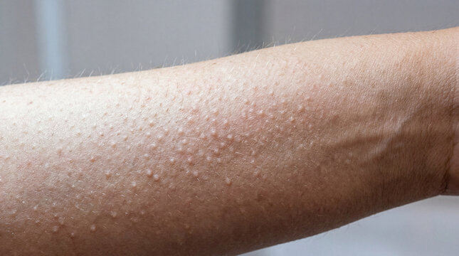 Surface of human skin on an extended forearm revealing countless minute raised bumps and subtle fine hair in clear light