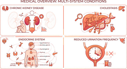 Obraz premium Medical overview infographic illustrating chronic kidney disease cholestasis liver dysfunction endocrine system glands and reduced urination frequency symptomsMedical overview infographic 