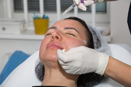 A cosmetologist performs lip augmentation injections on a middle-aged woman.
