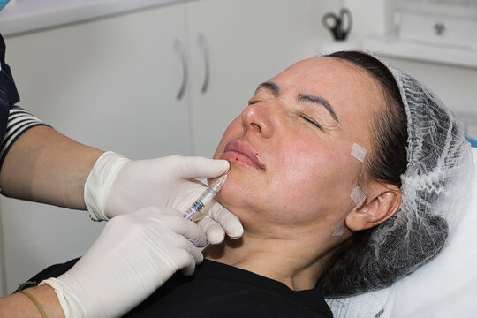 A cosmetologist performs lip augmentation injections on a middle-aged woman.