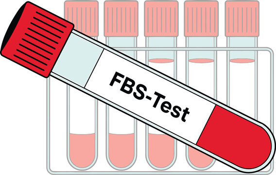 Medical test tube with blood sample labeled FBS-Test isolated on white background
