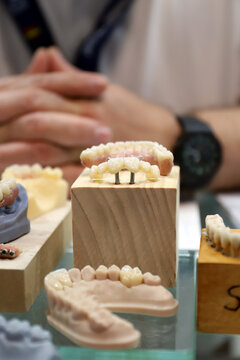 pr&oacute;tesis y modelos de dentadura dental humana