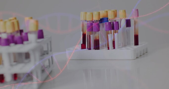 Displaying white rack holding blood tubes with colored caps on glossy benchtop, DNA overlay