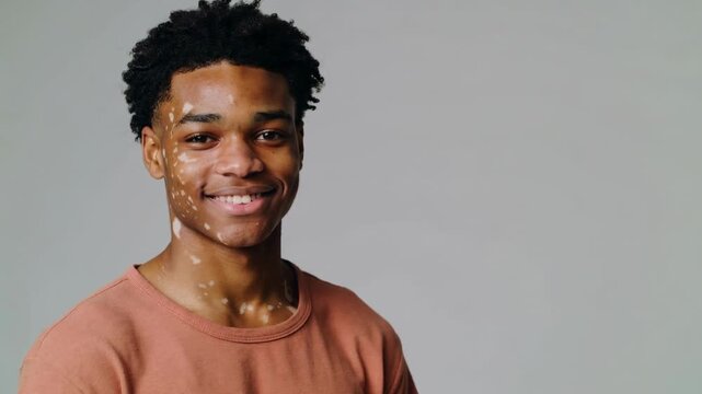 Young Black man with vitiligo in rust colored t-shirt smiling against grey background medium shot