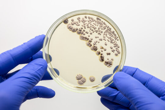 A large petri dish with colonies of bacteria from white nalta, the petri dish holds the teacher, krpnіm plan on the gray background.