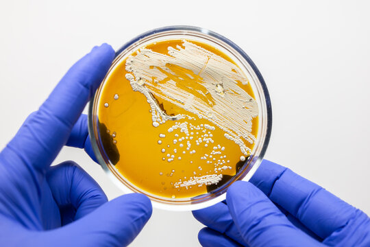 White plaque of actinobacteria on a brown Gause medium, a scientist holds a Petri dish with actinobacteria in his hand.