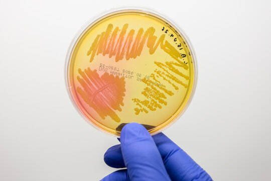 Petri dish showing the growth of pathogenic microorganisms on a selective medium.