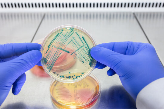 A scientist holds a petri dish with pseudomanada colonies in both gloved hands, against the background of other petri dishes with bacteria.