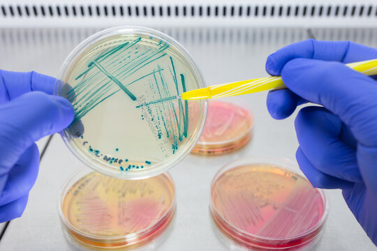 A scientist points with a ballpoint pen to individual colonies of pseudomonas in a petri dish, studying the analysis of the isolation of microorganisms.