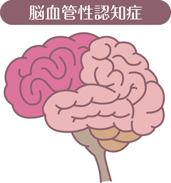 Vascular dementia brain illustration line