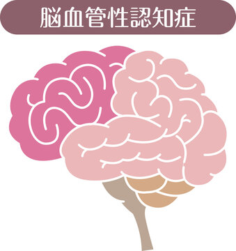 Vascular dementia brain illustration flat