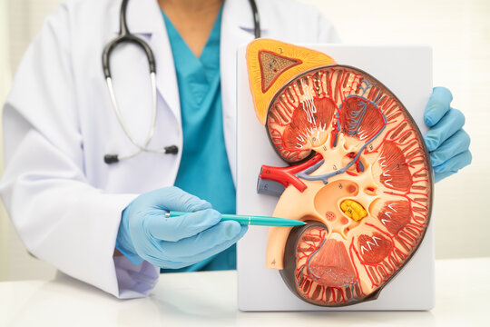 Kidney disease, Chronic kidney disease ckd, Doctor hold human model to treat and study in hospital.
