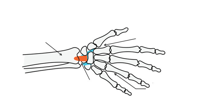 Scientific medical diagram of the human hand and wrist bones with labels and arrows for anatomy education or healthcare.