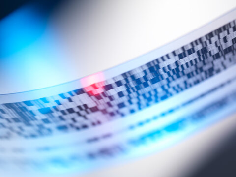 Macro view of a DNA autoradiogram showing genetic information