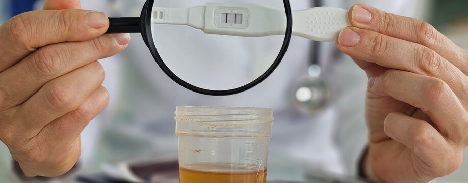 Urine test pregnancy test positive in the hands of a gynecologist