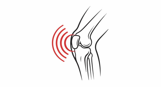 Stylized drawing of a human knee with radiating red pain signals
