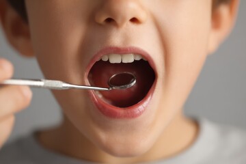 Fototapeta premium Dental explorer checkup on young patient