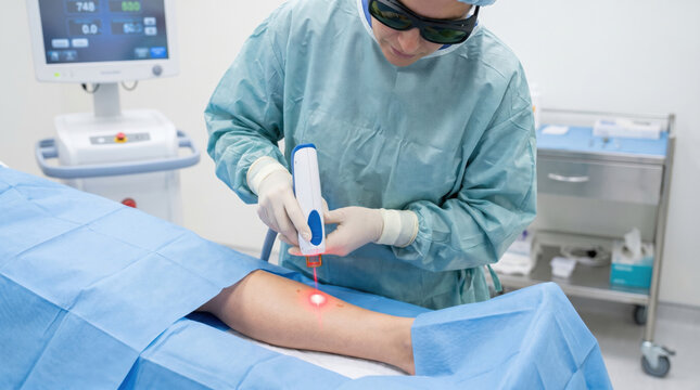 Focused doctor performs medical laser vein removal procedure on patient leg. Professional dermatology treatment in clean clinic with handheld device emitting focused light