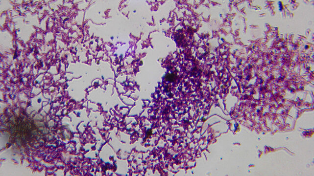 Candida Pseudohyphae and Yeast Cells Stained Microscopy Sli