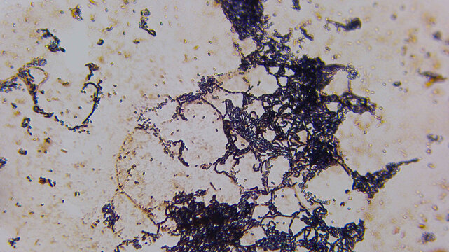 Filamentous Fungal Hyphae Network With Spore Chains Microsc
