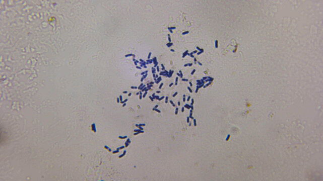 Gram Positive Bacilli Cluster Dark Blue Stain Light Microsc