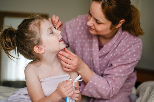 Mother treating child's chickenpox with cream indoors