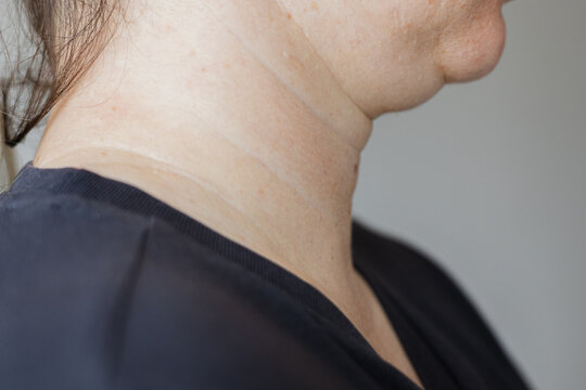 A close-up view of womans neck . Lines on the neck. Wrinkles, age-related changes, rings of Venus, goosebumps and double chin. Skin care.