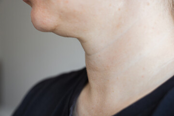 Fototapeta premium A close-up view of womans neck . Lines on the neck. Wrinkles, age-related changes, rings of Venus, goosebumps and double chin. Skin care.