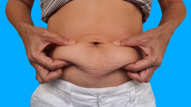 Woman with stomach pain, the fingers holding the flabbiness adipose sagging skin, large and overweight, flabby skin and cellulite on the body, belly fat and excess weight around the waist. 