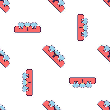 Seamless pattern of dental implants and teeth isolated on transparent background