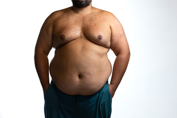 Naklejka premium Overweight man with abdominal obesity