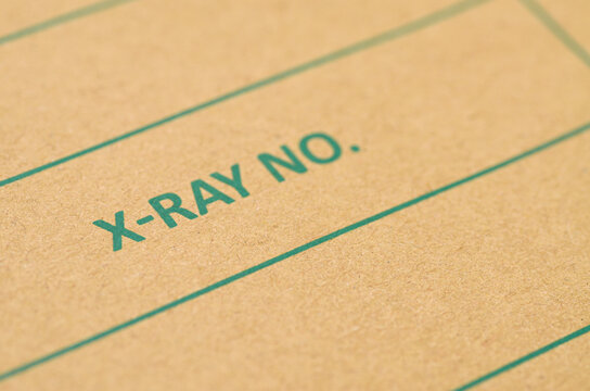 A close-up view of a brown manila medical folder specifically marked for X-ray filing and identification.