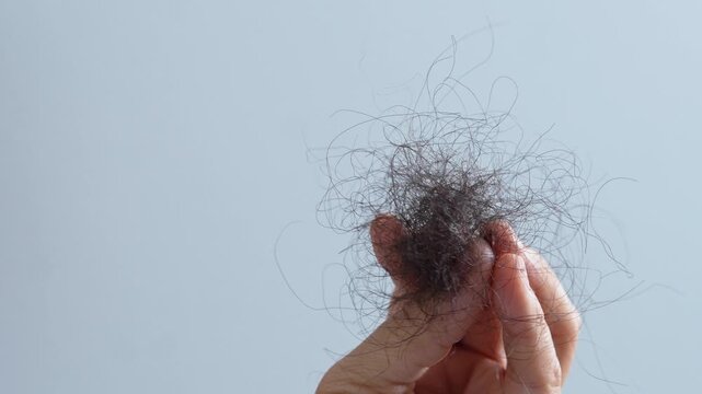 young woman her hair and have many hair loss. problem of maintenance losing by sad strain cancer patients after receiving chemotherapy. Healthcare and medical concept.