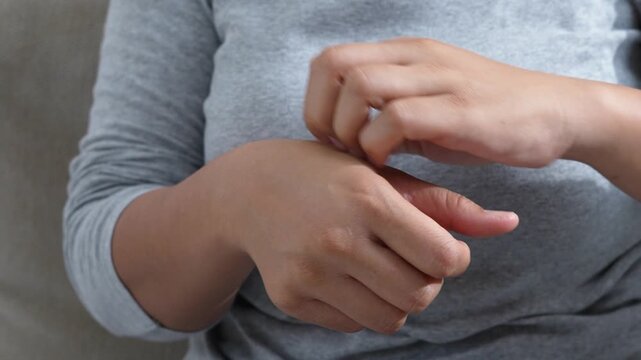 Dermatology, woman reaction from atopic, insect bites on her arm, hand in scratching itchy or rash of skin, treatment of beauty. Healthcare and medical concept.	

