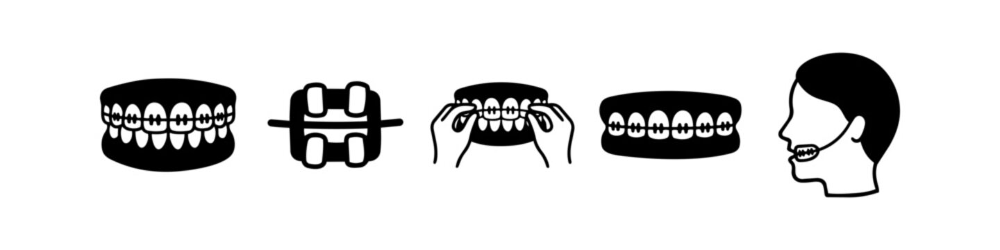 Set of black and white orthodontic icons featuring dental braces, brackets, rubber bands application, and headgear appliance for dental health and corrective treatment concepts.