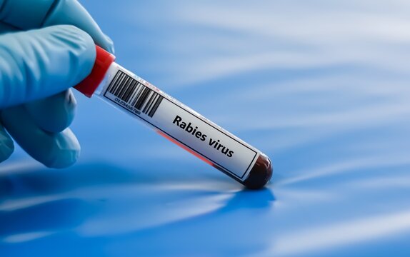 Blood sample tube for rabies virus test analysis.