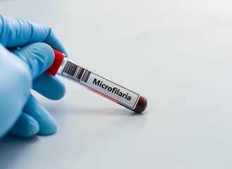 Obraz premium Blood sample tube for microfilaria test analysis.