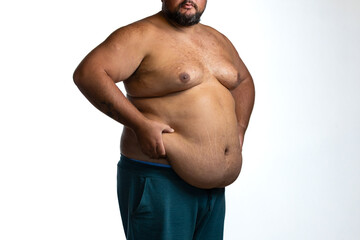 Naklejka premium Man with excess abdominal fat and obesity