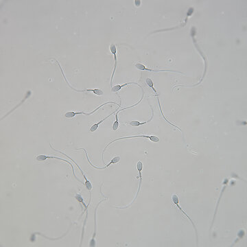 Sperm Cells Under Microscope For Fertility Analysis