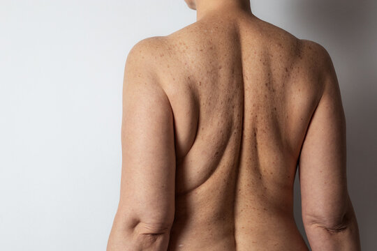 Self-acceptance and body positivity in aging