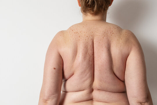 Embracing skin texture in body positivity and aging