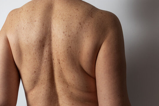 Embracing aging and body positivity in a natural way