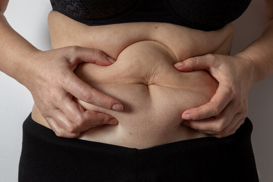 Embracing skin texture and body positivity in aging