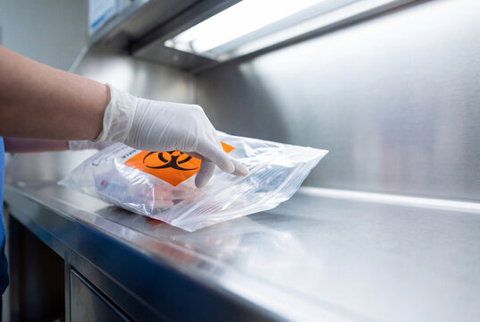 Gloved hand sealing a biohazard medical waste bag on a stainless steel surface in a hospital
