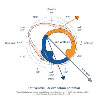When the left ventricle is excited, the anterior and posterior (i.e., inferior) myocardium is excited almost synchronously, and the resulting electrical potential is directed to the left and downward 