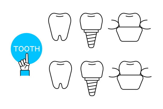 インプラントや入れ歯などの様々な歯のアイコン